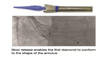 image 3 of Hydra TAVI Bio-prosthesis designed & developed by vascular innovations